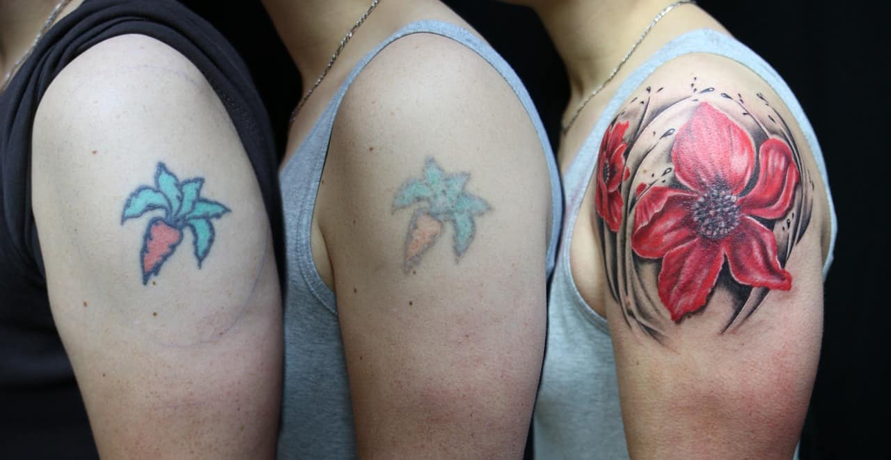 How Long Does Laser Tattoo Removal Take? - Vanish Laser Clinic Alexandria VA
